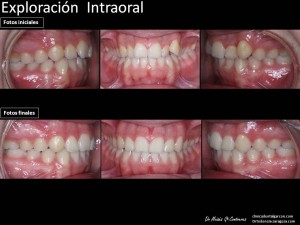 ANABEL LATORRE CIRIAintraoral