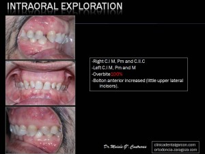 intraoral-pre
