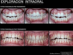funcional