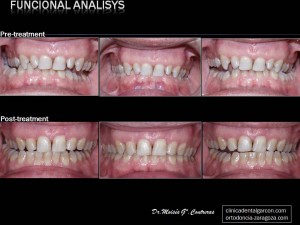 funcional-analisis-pos-treatment